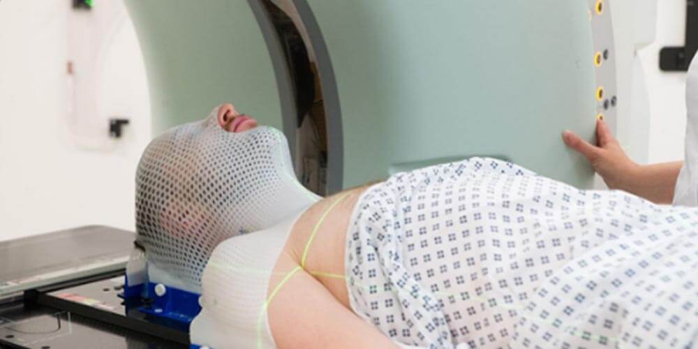 Es la radioterapia segura